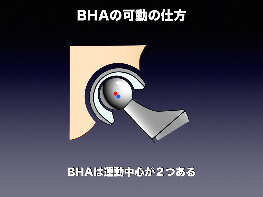 Bha Thaの股関節の動き方 整形外科のいろいろ