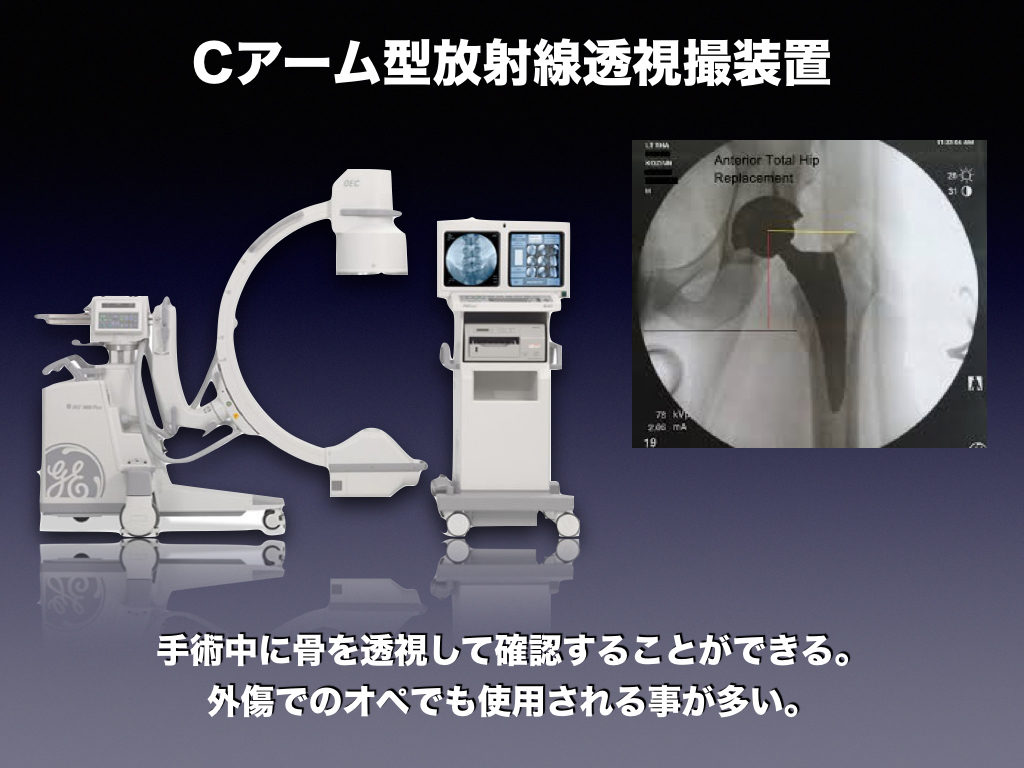 Cアーム型放射線透視装置