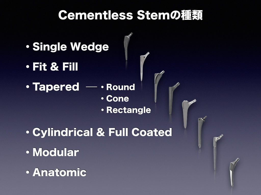 Cementless Stemの種類