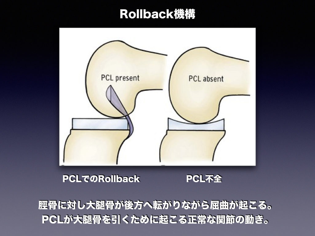 PCLによるRollback