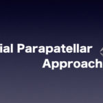 Medial Parapatellar Approachとは